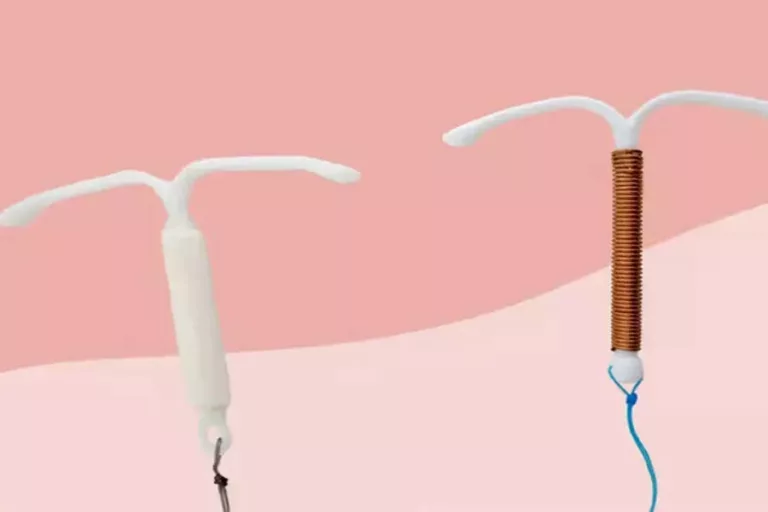 آیا آیودی (IUD) بر زمان پریود تاثیر می‌گذارد؟