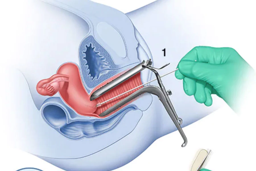 آزمایش (HPV)