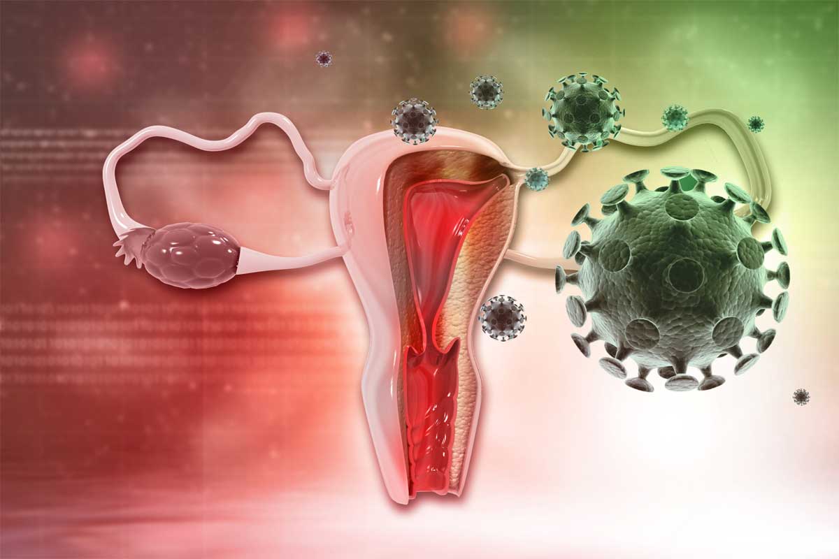 علائم HPV در زنان چیست؟