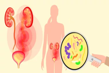 عفونت ادراری در زنان؛ علائم و روش‌های درمان