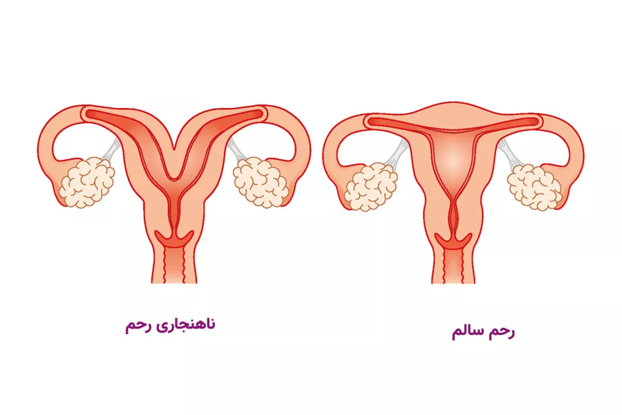 مشکلات رحمی