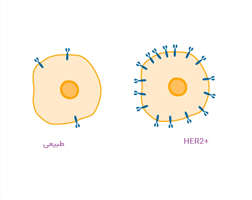 سرطان سینه (HER2) مثبت
